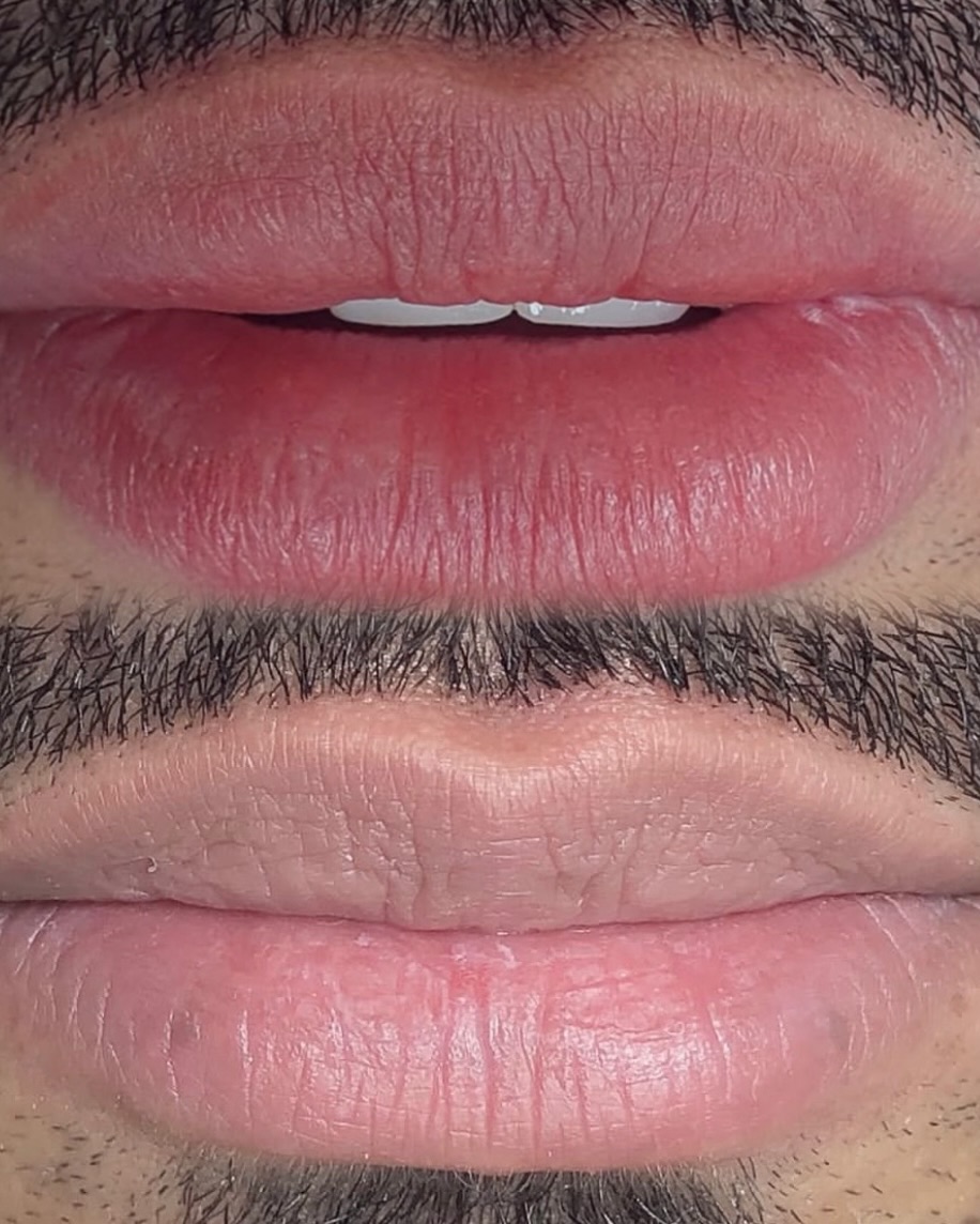Lip Colouring