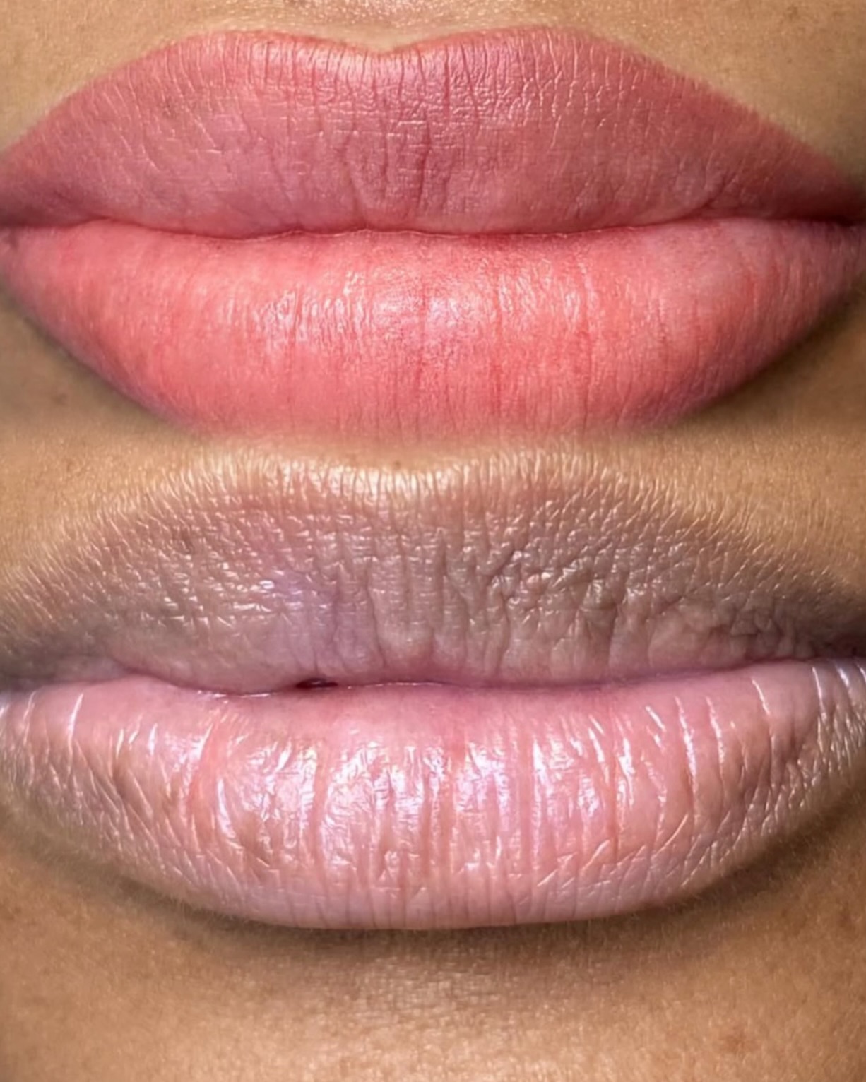 Lip Colouring - Before & After