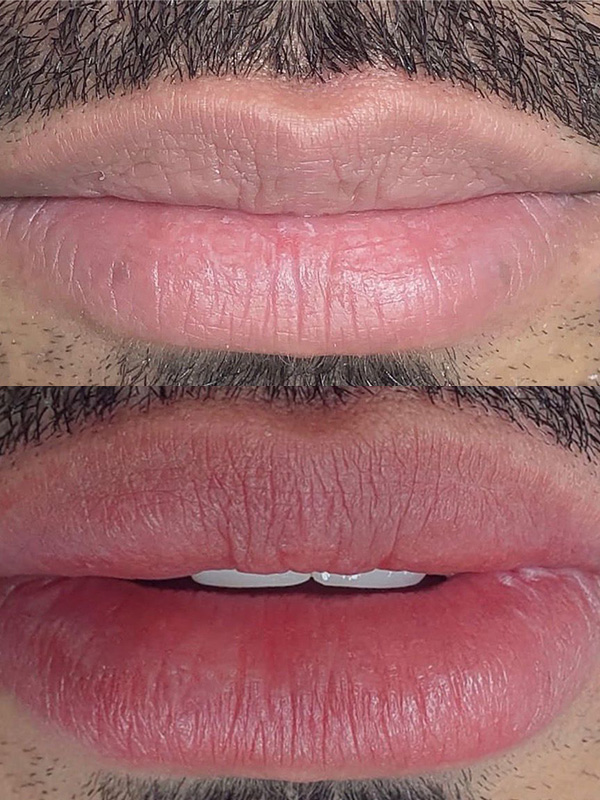 Lip tattoo lip blush before and after at The Bomb Beauty Aesthetics Sandton