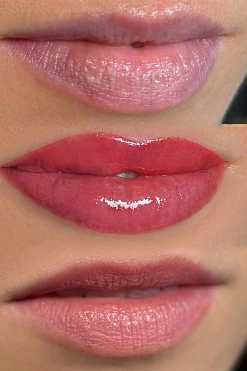 Advanced aesthetic procedures and treatments at The Bomb Beauty Aesthetics