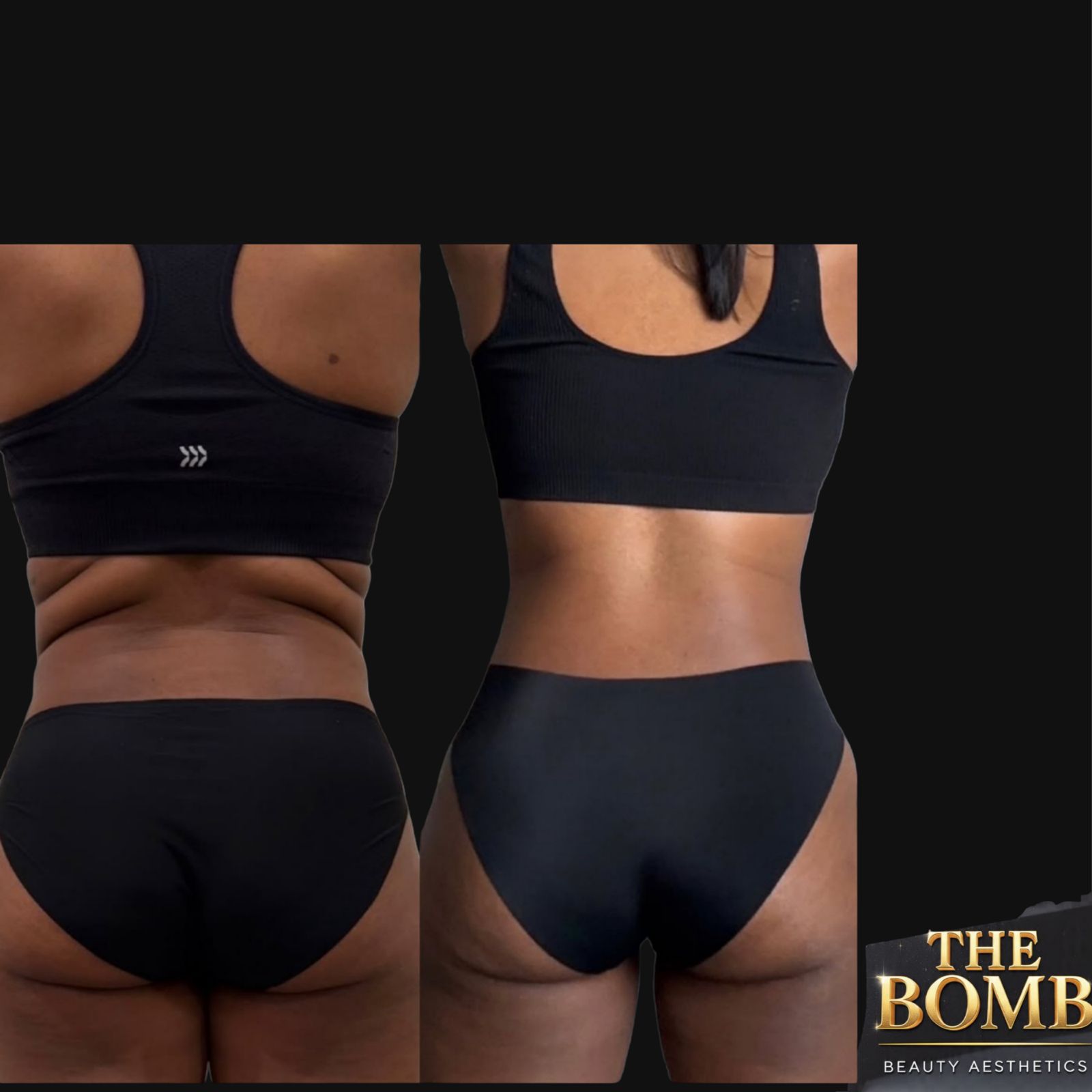 After - Flat Stomach Sculpt