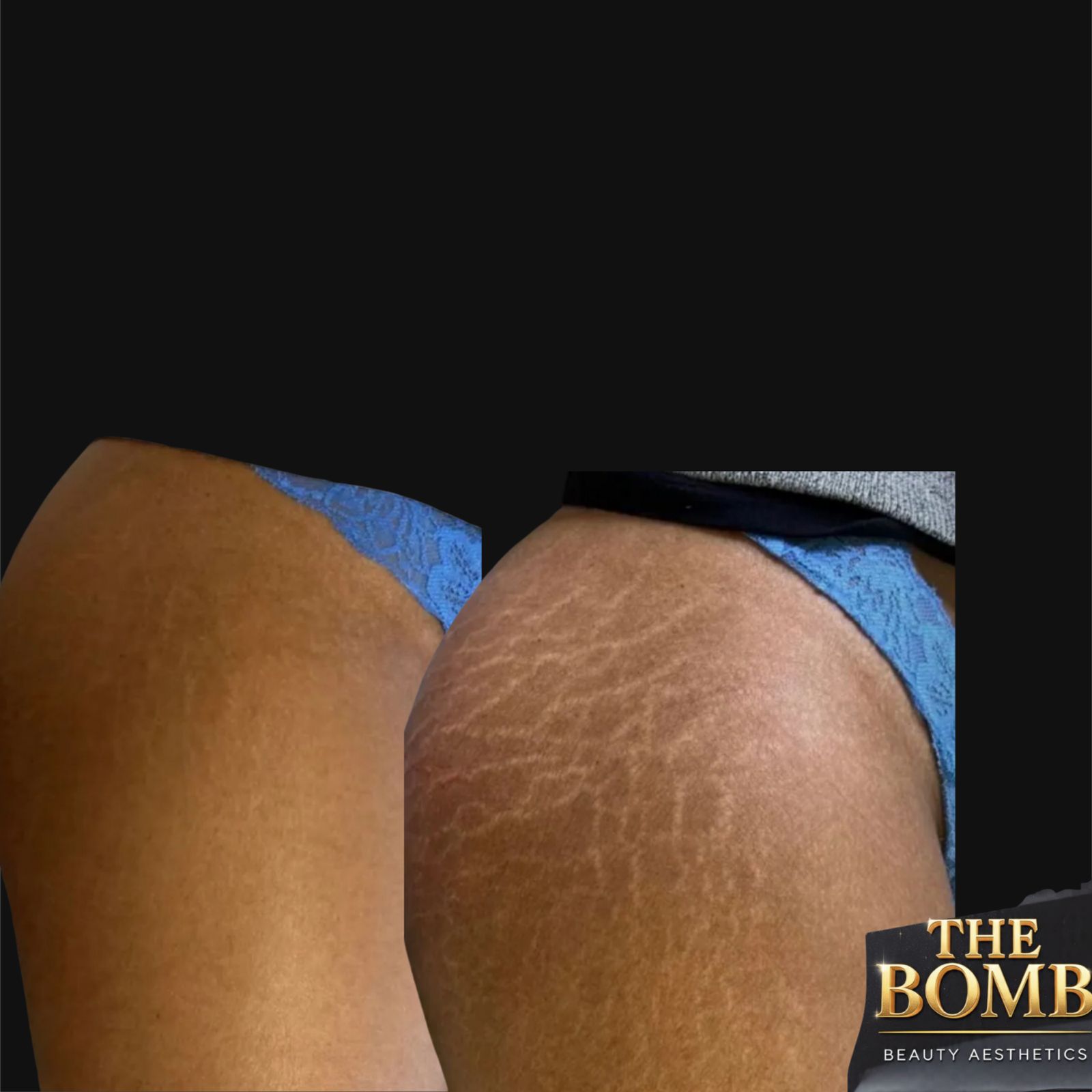 Client Result