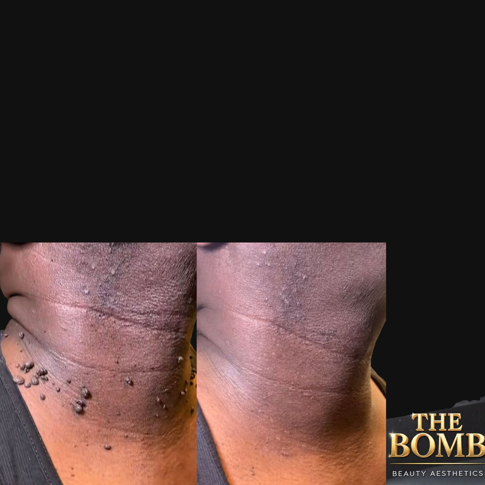Client Result