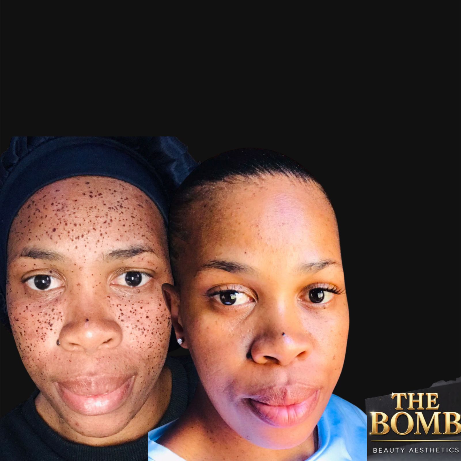 Client Result