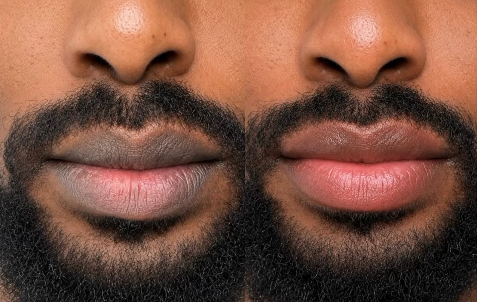 Lip Colouring After